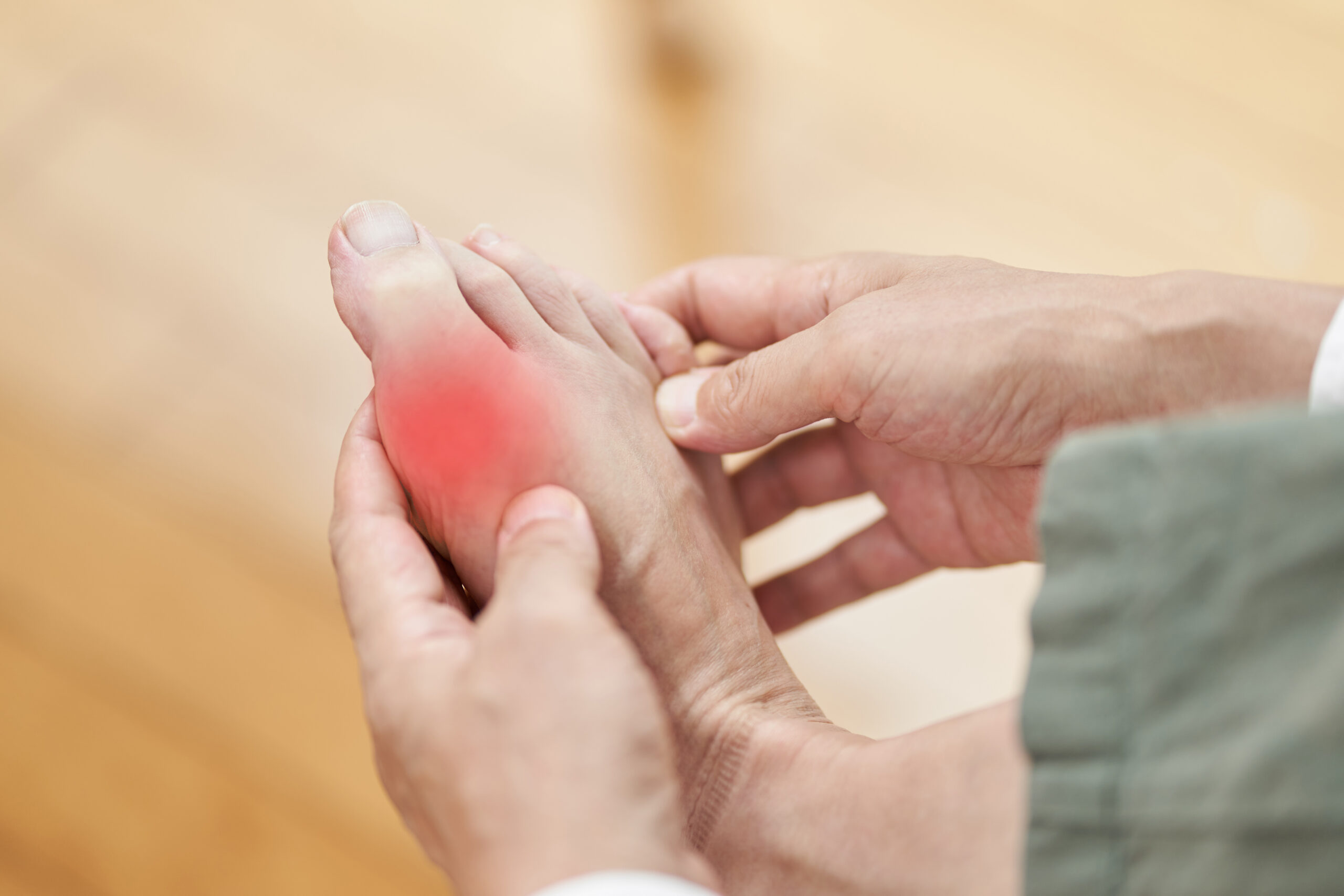 Older person holding foot showing inflammation on big toe from gout flare-up